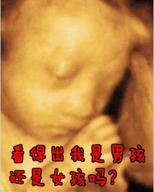 怎么查胎儿性别 怎么查胎儿性别