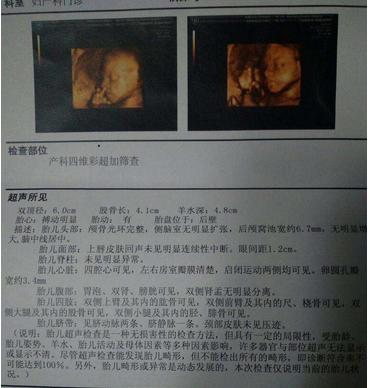 怎么查胎儿性别