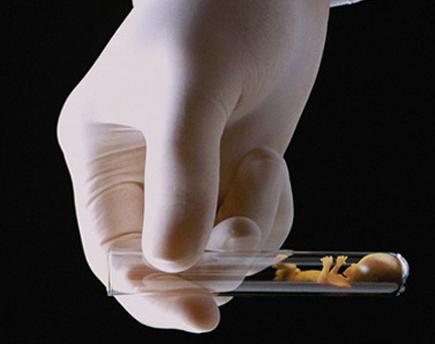 试管婴儿多少钱 试管婴儿多少钱