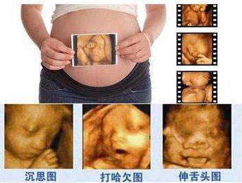 四维彩超什么时候做最好