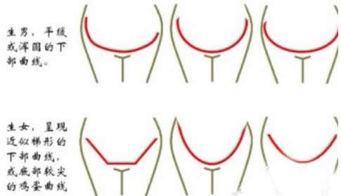 男孩女孩肚型区别图