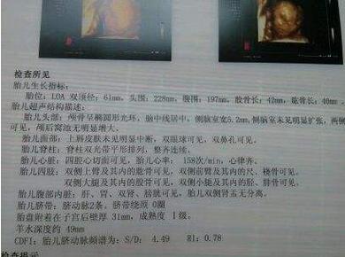 从彩超看生男生女