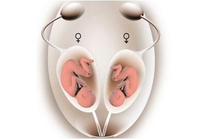 人工受精的费用