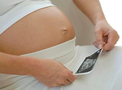 如何判断胎儿性别