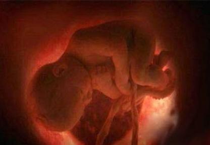 胎儿打嗝的原因 胎儿打嗝的原因