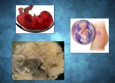怀孕4个月胎儿大小怀孕四个月的胎儿有多大