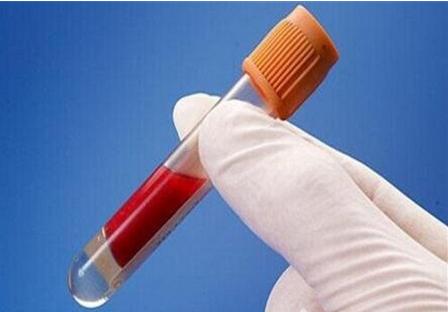 血常规检查项目 血常规检查项目