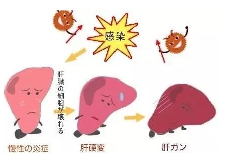 肝炎的早期症状 肝炎的早期症状