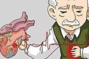 警惕心脏不好早期10个征兆(有心慌气短)