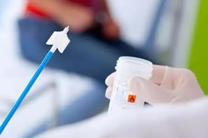 女性hpv检查前需要注意事项(避免月经期)