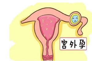 女性如何确诊宫外怀孕(确诊宫外孕3种方法)