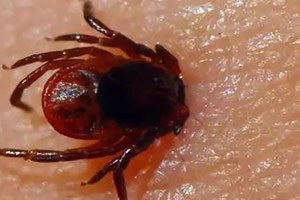 蜱虫咬人后会有什么症状怎么补救 蜱虫咬人后会有什么症状怎么补救