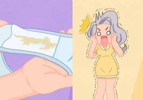 怀孕分泌物是褐色怎么回事 增多正常吗？