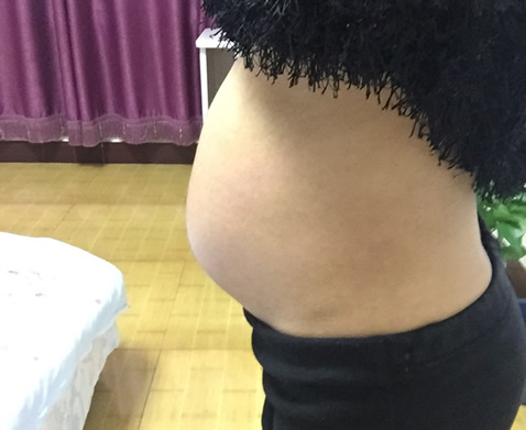 怀女宝腰长肉肚型图片(生男孩女孩的肚型)