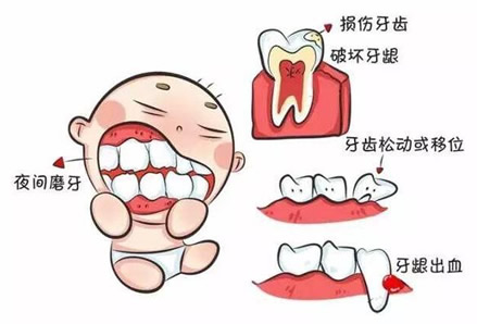 宝宝磨牙是什么原因引起的如何治疗