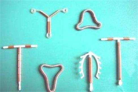 宫形环是什么样子图片 宫形环优缺点