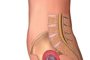 怀孕初期可以艾灸吗，孕期可以艾灸吗