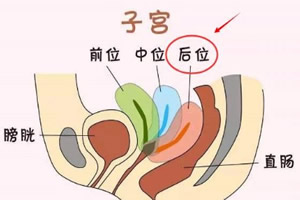 妇女子宫后位怀孕后的注意